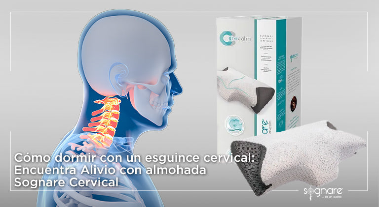 Cómo dormir con un esguince cervical: Encuentra alivio con almohada Sognare Cervical